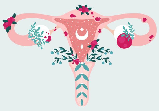 L'endométriose maladie gynécologique illustration utérus